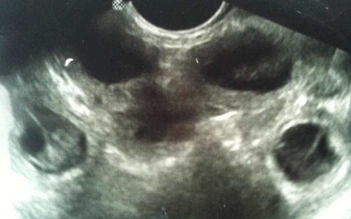 Medical ultrasound image showing internal structures.